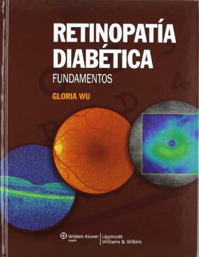 RETINOPATÍA DIABÉTICA