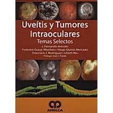 UVEITIS Y TUMORES INTRAOCULARES